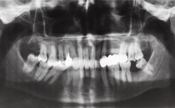 Radiografia panorâmica